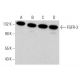 western blotting image from recommended FGFR-3 (E-7) monoclonal antibody replacement. Image 380591