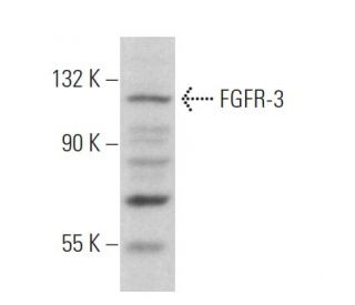 anti human fgfr3 antibody cross reactivity
