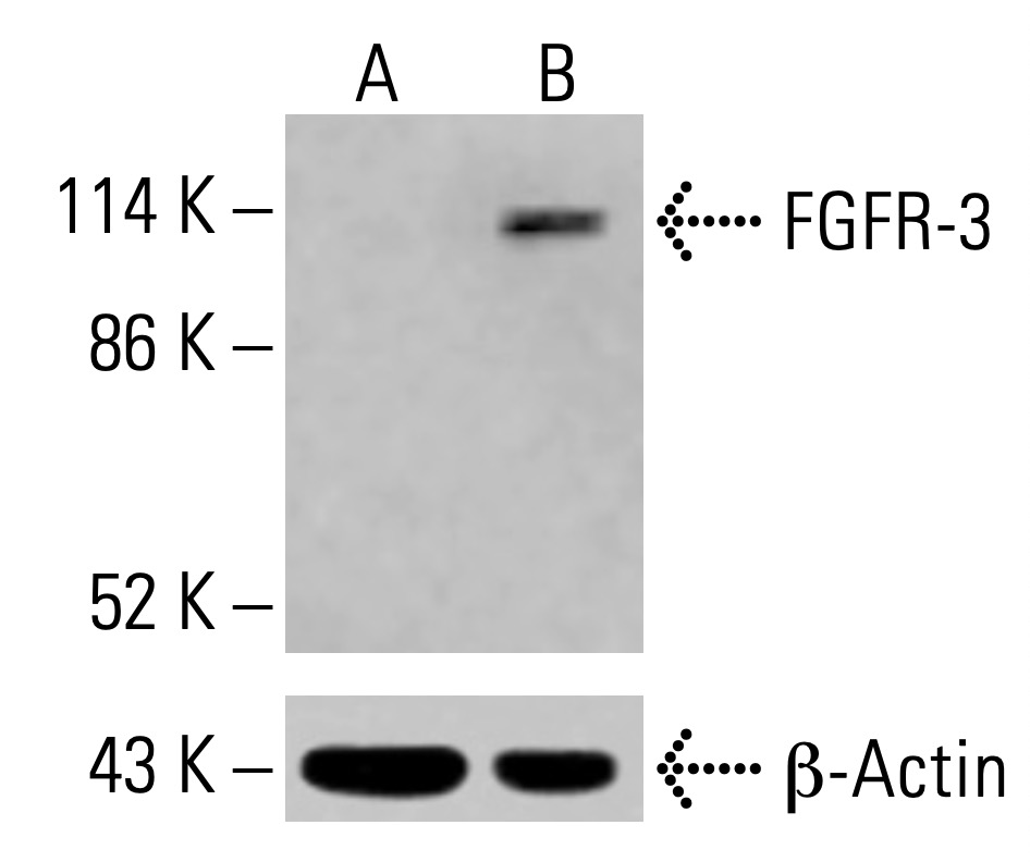 FGFR-3 Antibody (E-7) | SCBT - Santa Cruz Biotechnology