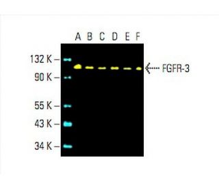 FGFR-3 Antibody (E-7) - Western Blotting - Image 392779