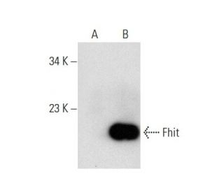 Fhit Antibody (C-7) - Western Blotting - Image 135501