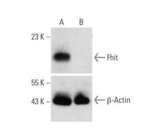 Fhit HDR Plasmid (h): sc-404220-HDR. Western blot analysis of Fhit expression in non-transfected control (A) and puromycin 