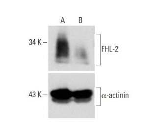FHL-2 CRISPR/CAS9 KO Plasmid (m): sc-420351. Western blot analysis of FHL-2 expression in empty vector control (A) and FHL 