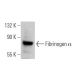 Fibrinogen α Antibody (A-6) - Western Blotting - Image 356330 