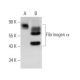 western blotting image from recommended Fibrinogen α (C-7) monoclonal antibody replacement. Image 372281