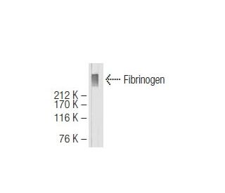 Fibrinogen Antibody (27C8) - Western Blotting - Image 64652