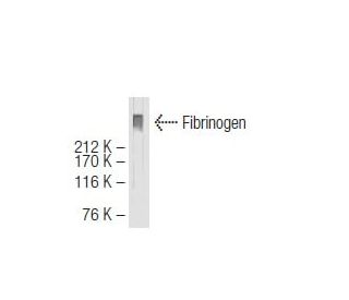 Fibrinogen Antibody (40F11) - Western Blotting - Image 64653