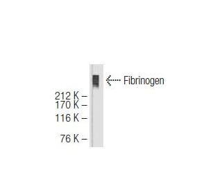 Fibrinogen Antibody (6G12) - Western Blotting - Image 64654