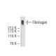 Fibrinogen Antibody (6G12) - Western Blotting - Image 64654