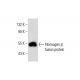 Fibrinogen β Antibody (C-1) - Western Blotting - Image 128464