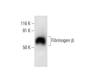 Fibrinogen &beta; Antibody (C-1) - Western Blotting - Image 289753 