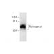 Fibrinogen β Antibody (C-1) - Western Blotting - Image 289753 