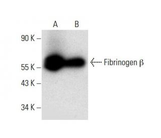 Fibrinogen &beta; Antibody (D-4) - Western Blotting - Image 304518 