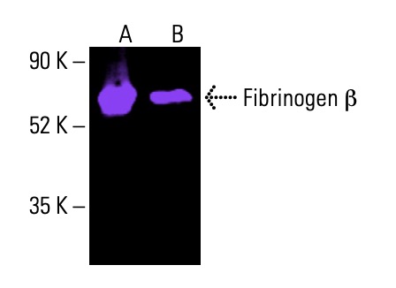 fibrinogen-beta-antibody-d-4-