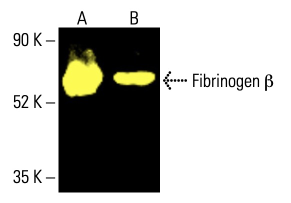 fibrinogen-beta-antibody-d-4-
