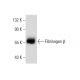 Fibrinogen β Antibody (E-5) - Western Blotting - Image 128465
