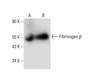 Fibrinogen &beta; Antibody (E-5) - Western Blotting - Image 304519 