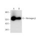 western blotting image from recommended Fibrinogen β (D-4) monoclonal antibody replacement. Image 304518