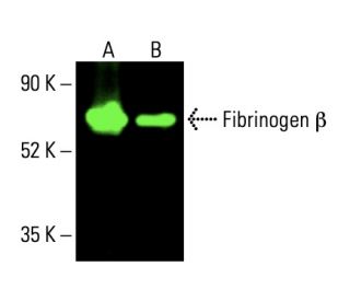 Fibrinogen β Antibody (D-4) - Western Blotting - Image 404996