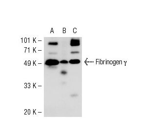 western blotting image from recommended Fibrinogen γ (D-6) monoclonal antibody replacement. Image 54230