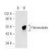 Fibromodulin Antibody (E-12) - Western Blotting - Image 81184