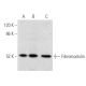 western blotting image from recommended Fibromodulin (H-11) monoclonal antibody replacement. Image 355464