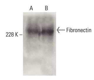 Fibronectin Antibody 568 SCBT Santa Cruz Biotechnology