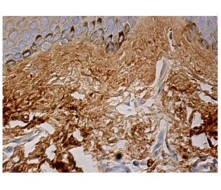 Fibronectin Antibody (A-11) - Immunohistochemistry - Image 160017 