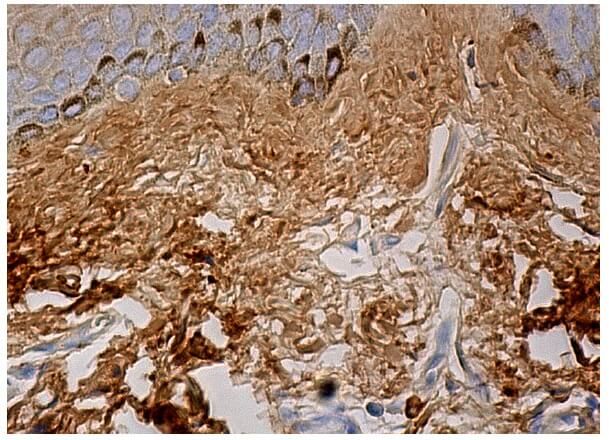 Fibronectin Antibody A 11 SCBT Santa Cruz Biotechnology