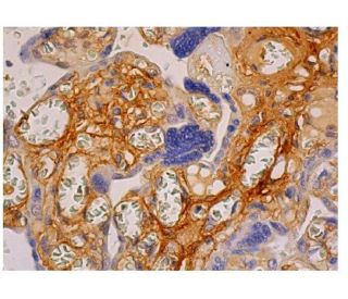 immunohistochemistry image from recommended Fibronectin (EP5) monoclonal antibody replacement. Image 349132