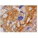 immunohistochemistry image from recommended Fibronectin (EP5) monoclonal antibody replacement. Image 349132