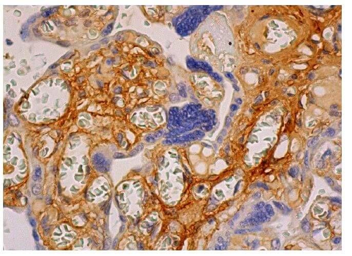 Fibronectin Antibody (EP5) | SCBT - Santa Cruz Biotechnology