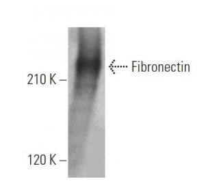 Fibronectin Antibody (EP5) - Western Blotting - Image 361795