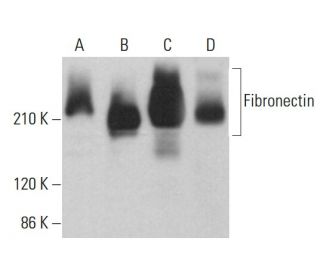 Fibronectin Antibody (Fn-3) - Western Blotting - Image 378967 