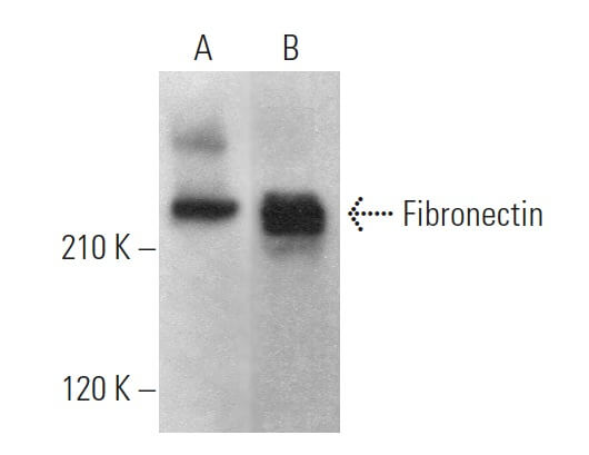 Fibronectin Antibody IST 1 SCBT Santa Cruz Biotechnology