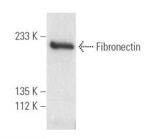 Fibronectin Antibody (P1F11) - Western Blotting - Image 5285