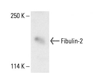 Fibulin-2 Antibody (3B9A11) - Western Blotting - Image 411780