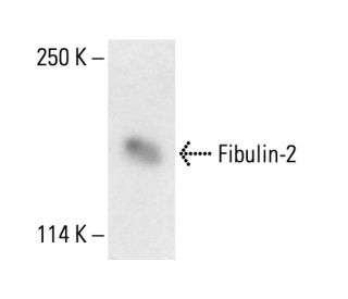 Fibulin-2 Antibody (7H4F6) - Western Blotting - Image 411779