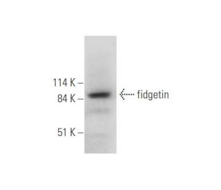 Fidgetin Antibody (F-2) | SCBT - Santa Cruz Biotechnology