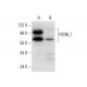 FIGNL1 Antibody (F-11) - Western Blotting - Image 308073 