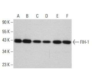 western blotting image from recommended FIH-1 (A-5) monoclonal antibody replacement. Image 381132