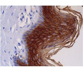FLG/Filaggrin Antibody (AE21) - Immunohistochemistry - Image 286487 