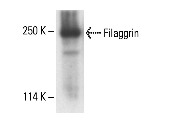 FLG/Filaggrin Antibody (AE21) | SCBT - Santa Cruz Biotechnology