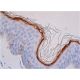 FLG/Filaggrin Antibody (AKH1) - Immunohistochemistry - Image 361444