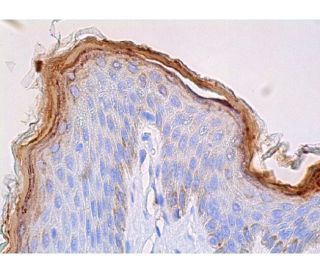 immunohistochemistry image from recommended FLG/Filaggrin (AKH1) monoclonal antibody replacement. Image 361443
