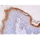 This polyclonal antibody has been discontinued. See our recommended <a href="filaggrin-antibody-akh1">FLG/Filaggrin (AKH1)</a> monoclonal antibody (sample data shown). immunohistochemistry image from recommended FLG/Filaggrin (AKH1) monoclonal antibody replacement. Image 361443