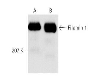western blotting image from recommended Filamin 1 (E-3) monoclonal antibody replacement. Image 5479