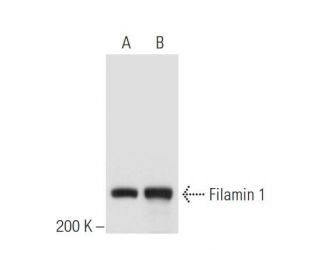 Filamin 1 Antibody (PM6/317) - Western Blotting - Image 57647 