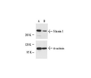 Filamin 1 siRNA (h): sc-35374. Western blot analysis of Filamin 1 expression in non-transfected control (A) and Filamin 1 
