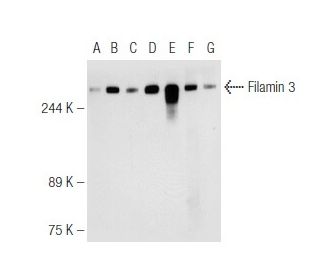 Filamin 3 Antibody (D-6) - Western Blotting - Image 93653